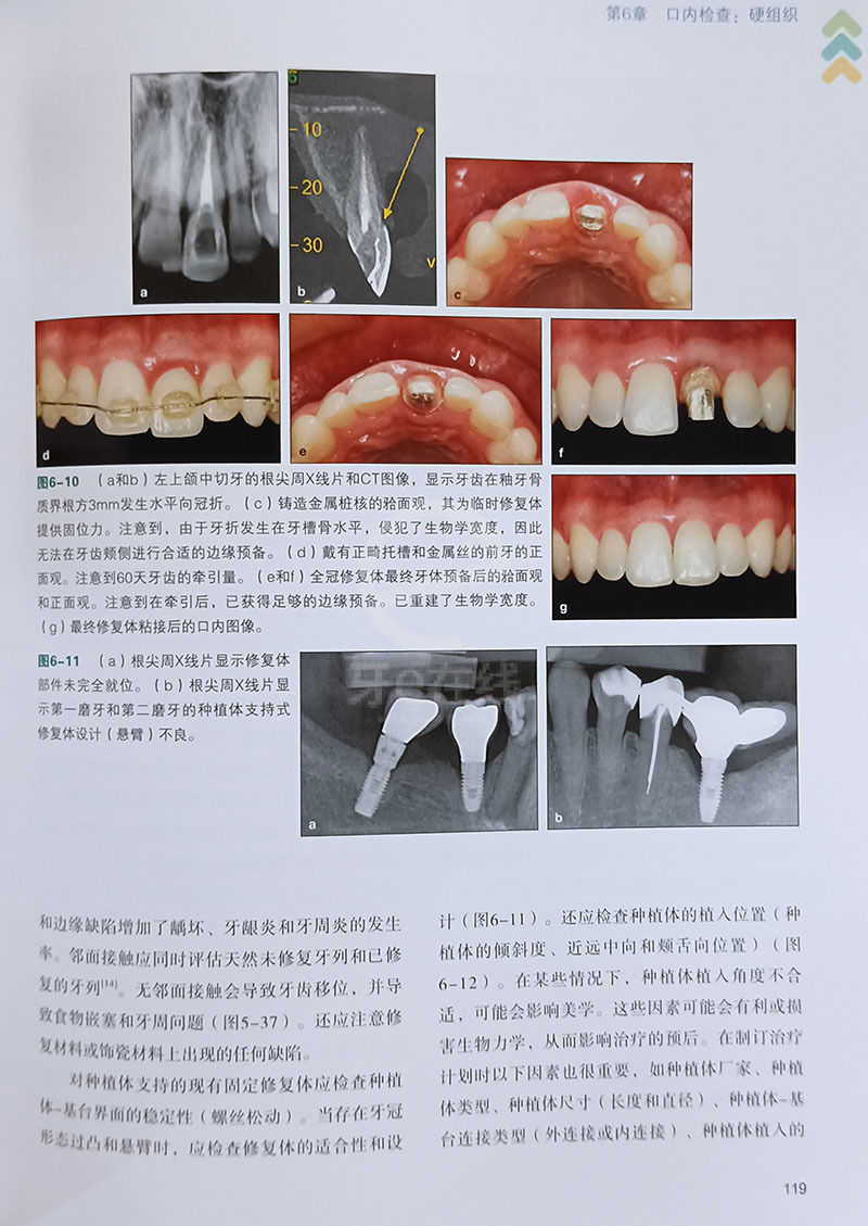 牙齒修復前沿技術(shù)觀點論述