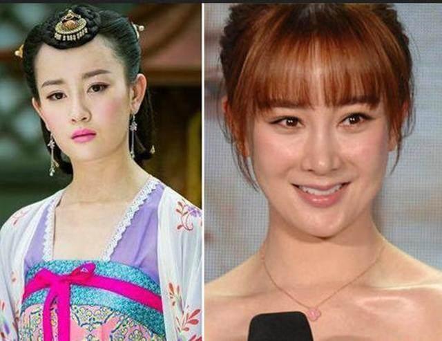 坦然面對整容，女明星的美麗新篇章之旅