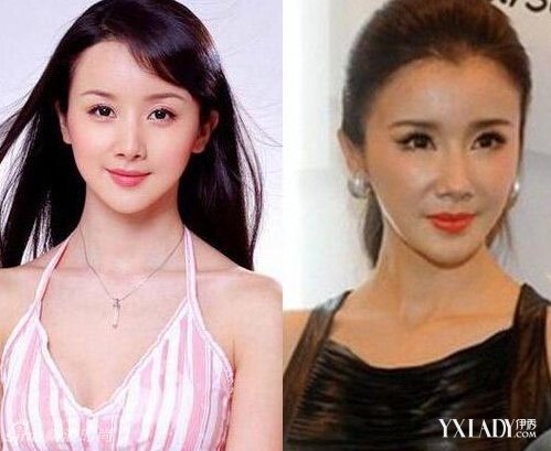 探秘明星整容的秘密，神秘美容小店的魅力所在！